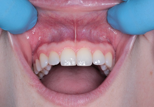 Splitting w stomatologii